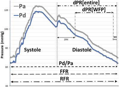 Comparison of Resting Full-Cycle Ratio and Fractional Flow Reserve in a German Real-World Cohort